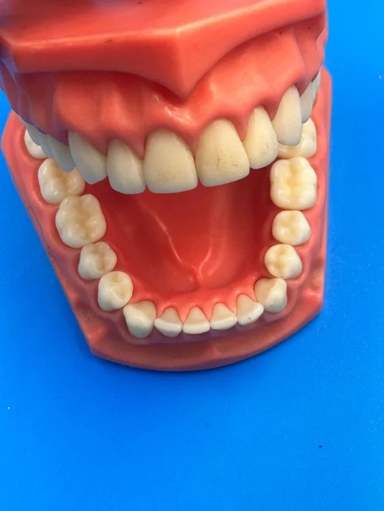 Vintage Dental Teaching Model - Coral Pink Educational Teeth Display