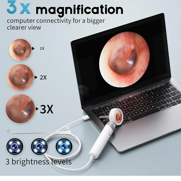 Digital Ear Camera with 3x Magnification