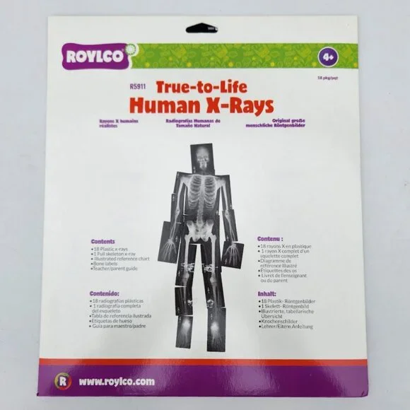 NEW Roylco True-to Life Human X-Rays - Age 4+ R5911 XRays Nancy Larson School Su