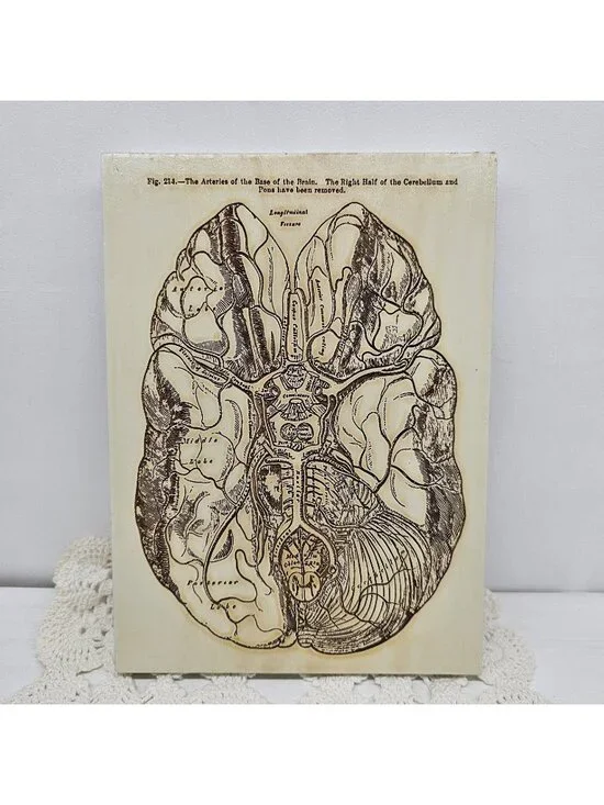Vintage Gray’s Anatomy Brain Arteries Wood Wall Plaque Medical Art Doctor Gift